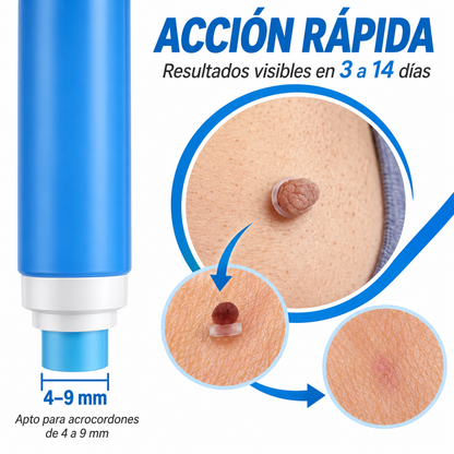 Kit Removedor de Acrocordones – Eliminación Fácil y Precisa en Casa