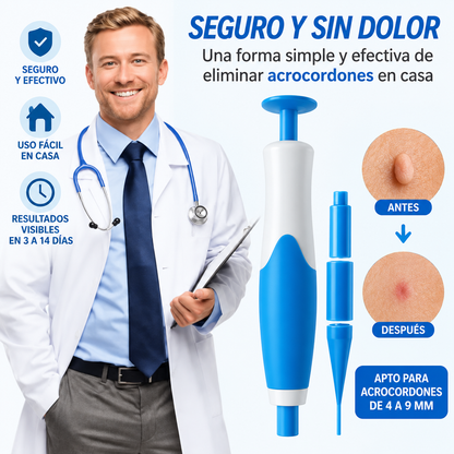 Kit Removedor de Acrocordones – Eliminación Fácil y Precisa en Casa